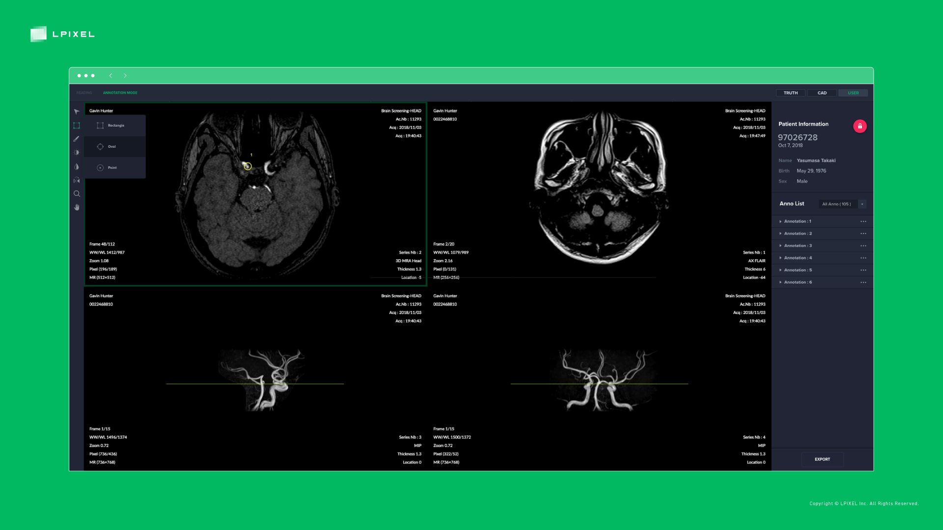 LPIXEL Announces Approval and Launch of Japan’s first Deep Learning ...