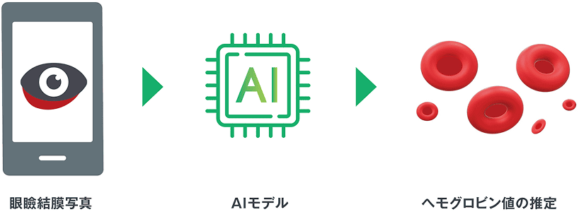 スマートフォンを用いた貧血予測AI